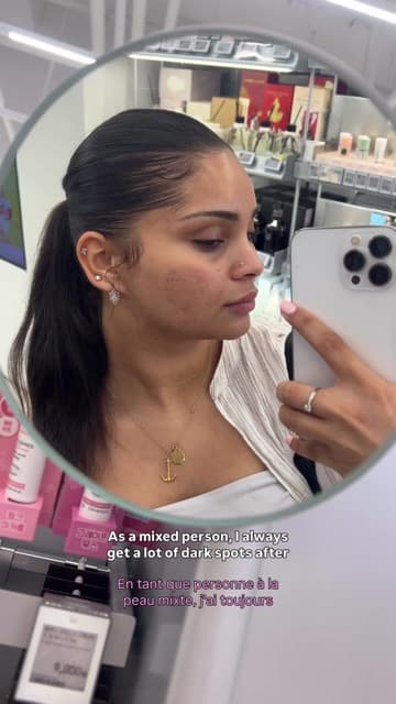 Frame from Amelie's (@amelieclarah) TikTok at Delphic Clinic in Gangnam, Seoul, recommending a treatment to followers with hyperpigmentation