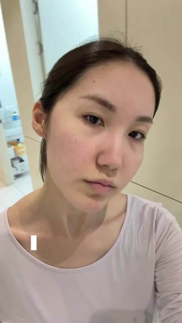 Vivie (@vivieee27) in a TikTok video one week after a needle-free Juvelook Booster with Mirajet at Delphic Clinic, Gangnam, Seoul