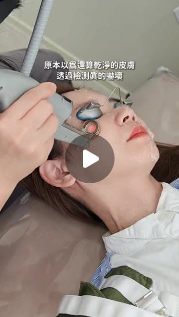 Lihui（@lilianwang_tw）在首爾江南 Delphic 診所做 PicoSure 皮秒與 Genesis 複合美白療程的 Instagram 影片