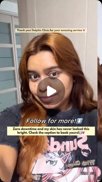 Yamini (@daebakyamini) during a PicoSure toning and Genesis brightening session at Delphic Clinic, Gangnam, Seoul — Instagram reel