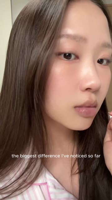justchlo (@justchlo222) in a TikTok skin diary after Potenza and Juvelook for pores and skin texture at Delphic Clinic, Gangnam, Seoul