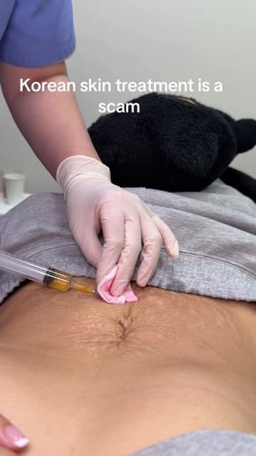 Priscilla Thach (@priscillathachh) in a TikTok video about her stomach two months after ONDA 40kJ and fat dissolving injections at Delphic Clinic, Gangnam, Seoul