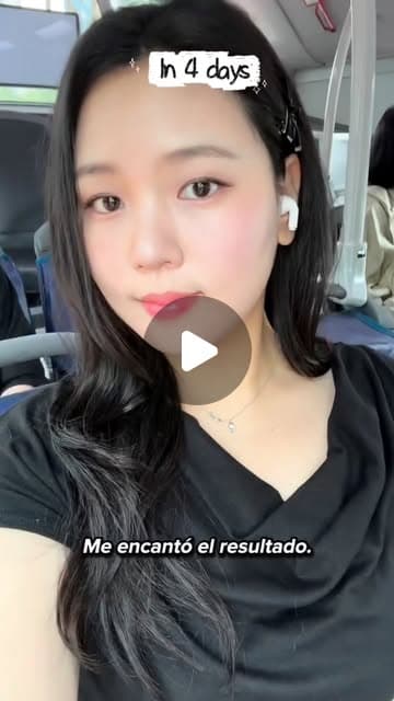 K_onni (@soy.k_onni) after acne care, Ultherapy, ONDA lifting and Juvelook Skin at Delphic Clinic, Gangnam, Seoul — Instagram reel